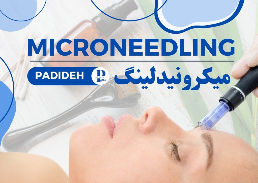 میکرونیدلینگ