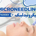 میکرونیدلینگ