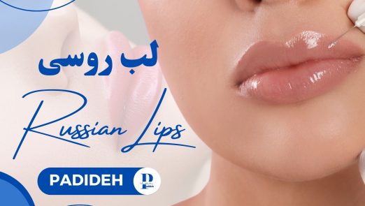 لب روسی